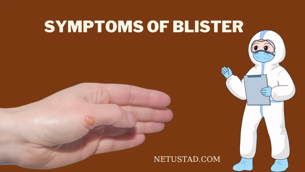 Symptoms of Blister